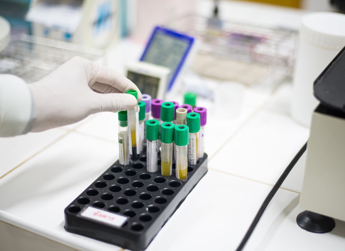 Lab tech puts sample into a holder with other samples