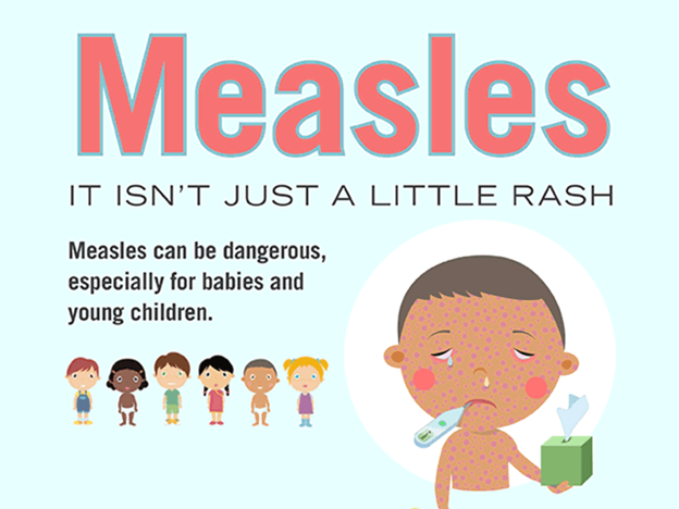 Health Advisory: Washington State Measles Cases Updates